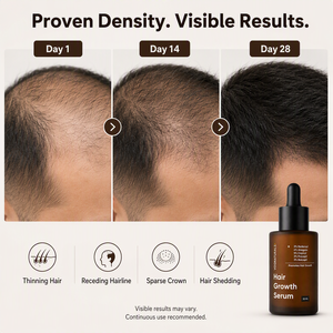 Tónico Capilar de Marca Privada con 3% de Redensyl, 5% de Capixyl, 4% de Anagain, 3% de Procapil, 3% de Baicapil y Romero para Densificar el Cabello - Product Image 4