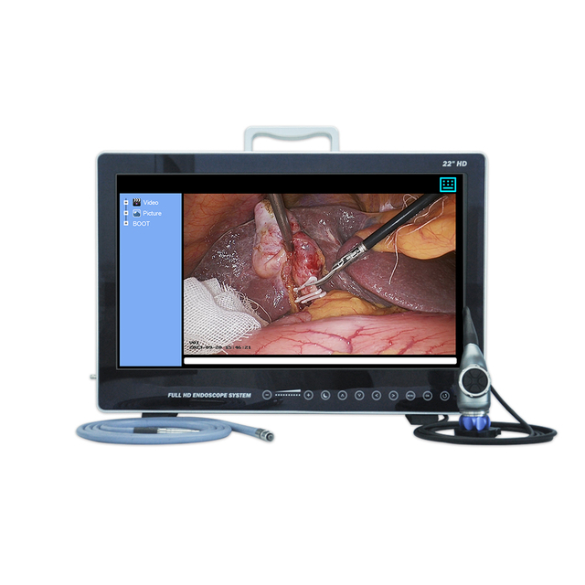 YKD-9122 Portable HD Medical Endoscope Camera System 22 Inch LCD Monitor for Medical Imaging Equipment