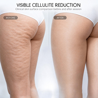 Appareil anti-cellulite 7-en-1 avec rouleaux et brosses, équipement de remodelage corporel pour salons de beauté, spas, distributeurs et vente en gros