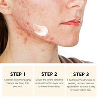 Ventes Flash Crème Visage Bio 30g Contre l'Acné, Rougeurs et Gonflements, Réparatrice