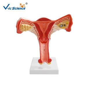 Modèle anatomique ovarien et utérin féminin Vic Education, modèle pédagogique de la reproduction humaine - Product Image 1