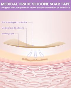 <span class=keywords><strong>Rouleau</strong></span> de ruban de feuilles de cicatrice de silicone d'élimination efficace et réutilisable de qualité médicale pour les cicatrices chirurgicales chéloïdes, césarienne - Product Image 2