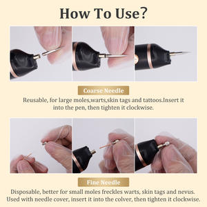 Outil de nettoyage des taches sombres, éliminateur de taches sombres, soin personnel, éliminateur de taches noires, <span class=keywords><strong>appareil</strong></span> de beauté du visage, stylo <span class=keywords><strong>pour</strong></span> <span class=keywords><strong>les</strong></span> grains de beauté, éliminateur de taches de rousseur - Product Image 6