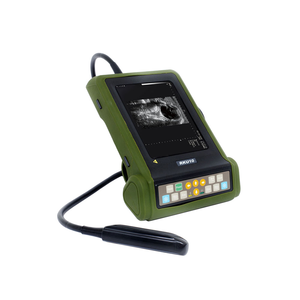 Medco-máquina de ultrasonido de mano, equipo médico, escáner de ultrasonido - Product Image 1