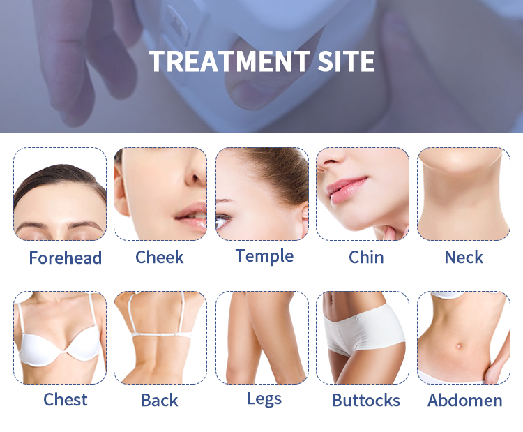 9d Lipo Hifu Liposuction Machine Skin Lifting Machine Fu4