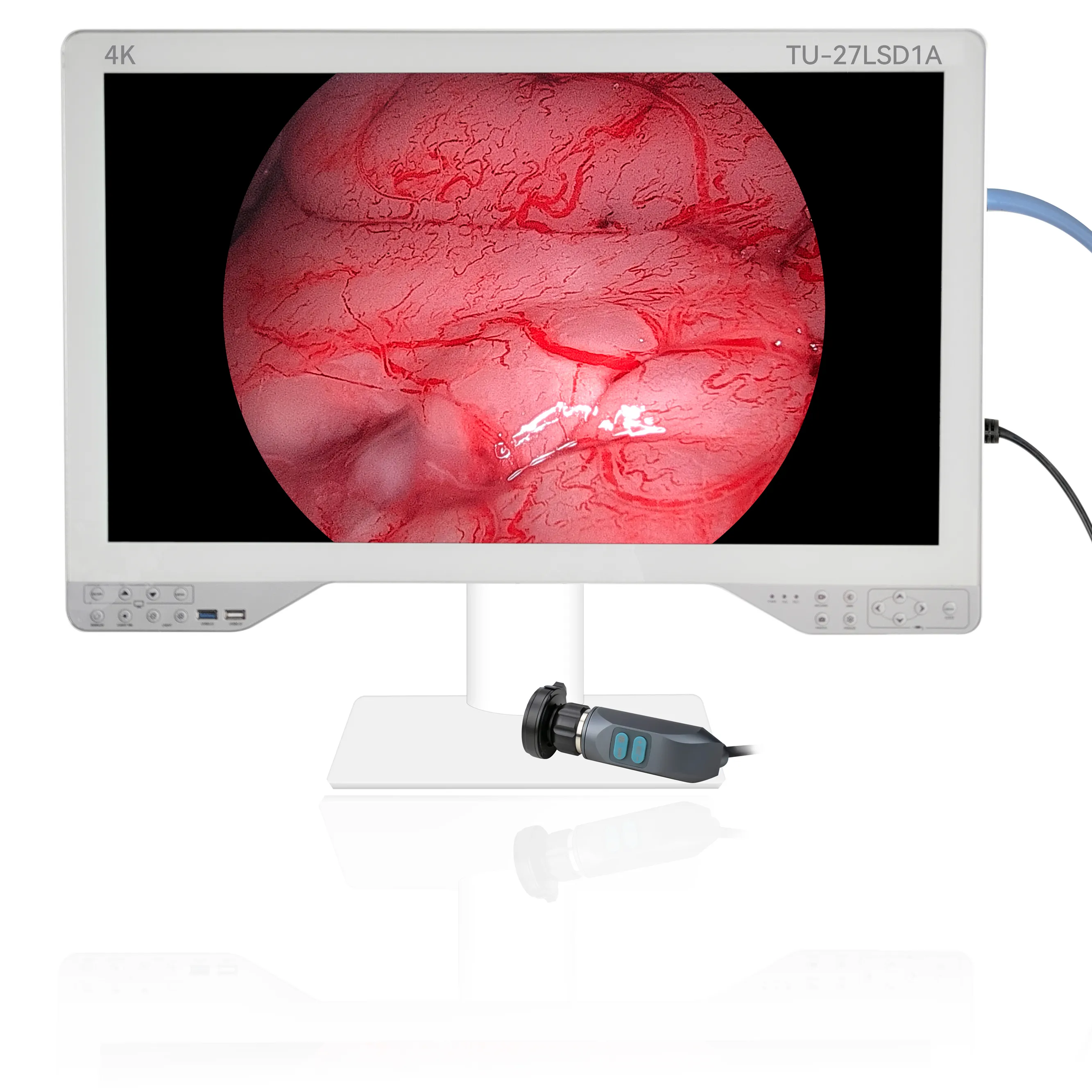 4K prix de gros 4 en 1 système de caméra endoscope avec moniteur LED lumière froide 32G USB pour oreille nez gorge