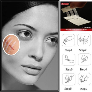 Chất Lượng Cao Bệnh Viện Phẫu Thuật Vô Trùng Vết Thương Đóng Cửa Dải Tốt Nhất Steri-Dải Băng Cho Da Đóng Cửa - Product Image 5