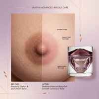 LANTIYA Krim Areola Pinkish Pemutih Puting Penghilang Melanin Pencerah Lembut Tidak Mengiritasi Melembapkan Perawatan Kulit Kosmetik