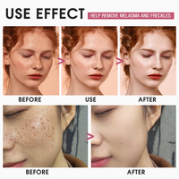 Crème blanchissante pour le visage sans logo sans paraben éclaircissant raffermissant et collagène Toute la meilleure crème pour blanchir