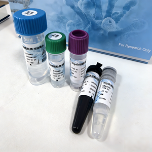 Ultra-Sensitiver Nipah-Virus Nukleinsäure-Testkit Fluoreszenz-Sonden-Methode zur Frühscreening - Product Image 1