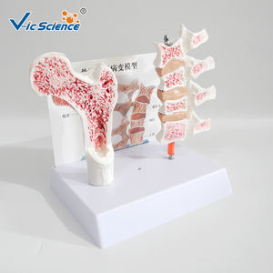 Modèle d'os pathologique en PVC pour l'ostéoporose avec carte dorsale - Modèle de <span class=keywords><strong>squelette</strong></span> <span class=keywords><strong>humain</strong></span> - Product Image 3
