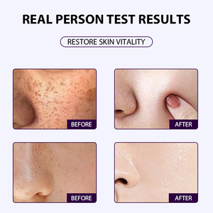 Nourrir la peau Meilleur <span class=keywords><strong>sérum</strong></span> visage Anti-âge raffermissant hydratant Sérums ordinaires - Product Image 5