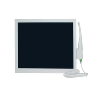 Système de caméra intra-orale haute résolution avec objectif macro pour usage dentaire et moniteur PC