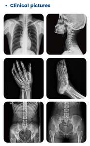 Alta frecuencia 20kw monofásico 220V Digital móvil Hospital máquina de rayos X doble columna <span class=keywords><strong>DR</strong></span> máquina de rayos X - Product Image 6