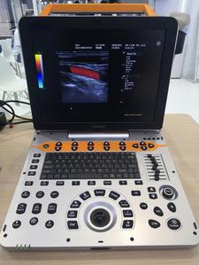 Ecógrafo Doppler Color Portátil de Grado Profesional Dawei DW-P60 con Imágenes de Elastografía para Diagnóstico Veterinario - Product Image 5