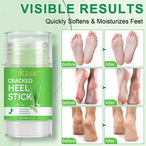 IKZEE Etiqueta Privada melocotón <span class=keywords><strong>aloe</strong></span> <span class=keywords><strong>vera</strong></span> agrietado talón palo Bálsamo hidratante profundo antigrietas Crema <span class=keywords><strong>para</strong></span> pies <span class=keywords><strong>para</strong></span> suavizar el talón - Product Image 3