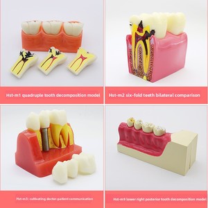 Modelo de Enseñanza Dental para la Comunicación Médico-Paciente, Restauración de Implantes Dentales <span class=keywords><strong>Removibles</strong></span>, Uso Clase I - Product Image 3