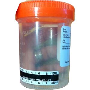 La bande numérique de thermomètre de tasse d'<span class=keywords><strong>urine</strong></span> d'affichage à cristaux liquides de <span class=keywords><strong>test</strong></span> d'<span class=keywords><strong>urine</strong></span> d'hôpital en gros peut être personnalisée - Product Image 3