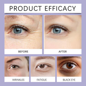 ครีมบำรุงรอบดวงตา Aha Bha เรตินอล 30 กรัม รับผลิตแบบ OEM แบรนด์ส่วนตัว ดูแลผิวสามเท่า ผลัดเซลล์ผิว กระชับผิว กระจ่างใส - Product Image 6