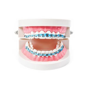<span class=keywords><strong>Brackets</strong></span> Dentales Decorativos, <span class=keywords><strong>Brackets</strong></span> <span class=keywords><strong>de</strong></span> Moda para <span class=keywords><strong>Dientes</strong></span>, <span class=keywords><strong>Brackets</strong></span> <span class=keywords><strong>de</strong></span> Ortodoncia, Kit <span class=keywords><strong>de</strong></span> <span class=keywords><strong>Brackets</strong></span> <span class=keywords><strong>de</strong></span> Belleza - Product Image 1