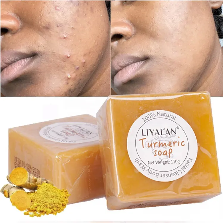Turmeric Soap Face Clean Remove Pimples Dark Spots Face Skin Whitening Anti Acne Handmade Organic Turmeric Bath Toilet Soap