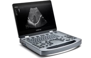 Vente flash - Échographe numérique couleur Doppler portable Sonoscape X5V de haute qualité pour vétérinaires - Product Image 2