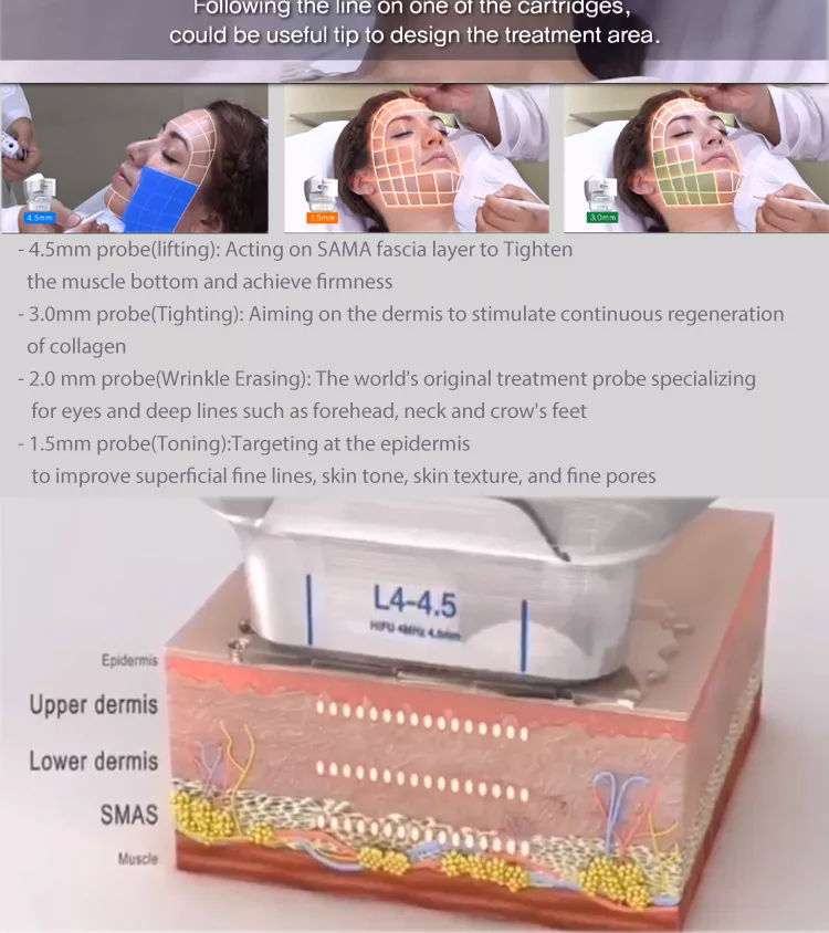 2022 2 Handle Dual Control 7D Hifu Machine For Skin Tightening And Body Slimming
