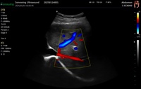 Système de diagnostic par ultrasons Doppler couleur 3D 4D Machine à ultrasons couleur pour ordinateur portable avec fonction PW CW