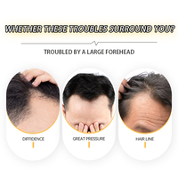 AU 15x2.8cm V-Type Bio Skin Postiche Frontal Attaché à la main Remy Grade Male Patch avec cheveux chinois pour la naissance des cheveux encastrée