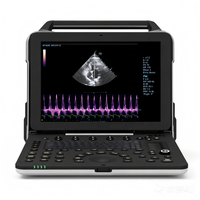 Système d'échocardiographie cardiaque vétérinaire portable couleur Doppler de type ordinateur portable pour hôpital vétérinaire