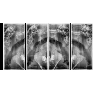 SY-M060 Appareil <span class=keywords><strong>panoramique</strong></span> céphalométrique de haute précision à double capteur indépendant pour la mesure et le diagnostic de l'arcade <span class=keywords><strong>dentaire</strong></span> en clinique orthodontique - Product Image 6