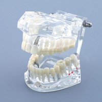 [AiFan Dental], producto en oferta, 2001, implante, modelo de estudio dental tipodont