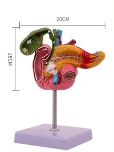 Modelo Anatómico de Patología Humana de la Vesícula Biliar en Material PVC para Aprendizaje y Entrenamiento en Ciencias Médicas - Product Image 3