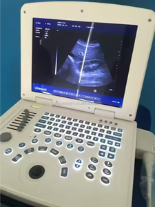 Vente chaude Médical B/W Ultrason <span class=keywords><strong>S50A</strong></span> Ultrason 2D Cahier de Grossesse Gynécologique USG Machine à Ultrasons - Product Image 3