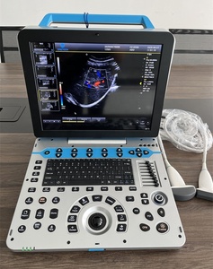 C57 डेस्कटॉप सोसो 4 डी 5 डी अल्ट्रासाउंड उपकरण पूर्ण डिजिटल रंग डॉपलर पोर्टेबल अल्ट्रासाउंड मशीन मानव के लिए - Product Image 4
