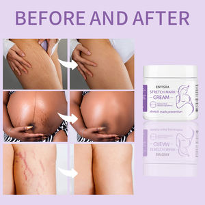 Crème Naturelle Anti-Vergetures ODM OEM, Crème Éliminatrice de Vergetures de Grossesse pour Femmes Enceintes (Jambes et Cuisses) - Product Image 2