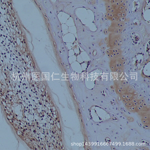 Immunohistochemistry Tissue Sample Pathology Service Paraffin Sections Cell Slides Frozen Sections Biotechnology Lab Reports - Product Image 1