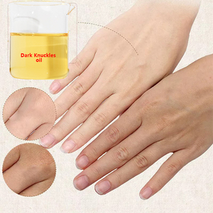 Huile Éclaircissante pour les Taches Sombres des Articulations, Crème Blanchissante la Plus Efficace, Crème Corporelle Forte pour Éliminer les Taches Noires, Ingrédients Pré-Mélangés - Product Image 3
