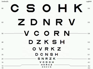 Equipo Óptico para Examen de la Vista, Optotipo LED, Tabla de Agudeza Visual Digital LED, Tablas de Visión Automáticas para Hospitales Oftalmológicos - Product Image 4