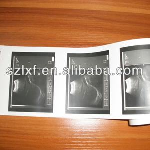 Papel Térmico Médico UPP-110HG 110mm X18m Ultrasónico UPP-110S Papel para Caja Registradora Certificado ISO9001 Alta Definición FOISON - Product Image 4