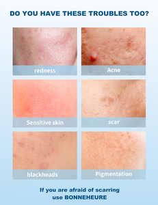 Suero de colágeno Whelk Eliminación de espinillas y acné Reducción de cicatrices 30ml Suero líquido Iluminador Suero facial - Product Image 6