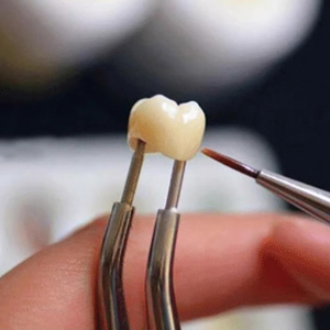 Dents de zircone dentaire Pince à <span class=keywords><strong>couronne</strong></span> intérieure Support de glaçure en céramique prenant des dents de <span class=keywords><strong>couronne</strong></span> tenant des outils de laboratoire - Product Image 5