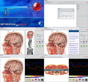 Escáner 3D de Alta Calidad en Oferta, Metatron Hunter 4025 NLS, Terapia de Biorresonancia Versión 2026, Software Informático Bioplasm Gratuito - Product Image 6