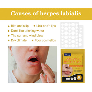 El Nuevo Parche para Herpes Bucal Está Diseñado para Aliviar la Hinchazón, las Ampollas y las Úlceras, y Es Fácil de Usar. - Product Image 4