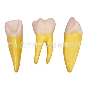Modelo de diente humano ampliado 12 veces con molde desmontable para la anatomía del diente, pulpa, nervio, incisivos, caninos y molares. - Product Image 3