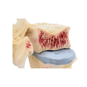 Modèle d'ostéoporose osseuse humaine avec contraste de texture palpable distinct - Product Image 4