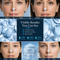Crème Visage Hydratante, Apaisante et Réparatrice à l'Acide Azélaïque, Céramide et Peptide de Cuivre Anti-Rides pour Usage Diurne – Marque Blanche OEM/ODM