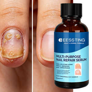 Hot Sale Strengthen Brittle Split Fingernail Toenail Nourishing Softens Thins Thick Multi-Purpose <b>Nail</b> Repair Serum - Product Image 1