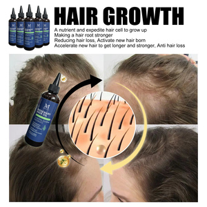 Natürliches 200ml Rosmarin-Haaröl Haarwuchs-Förderung Haarausfall-Prävention Kopfhautpflege Nachhaltige Eigenmarke Rosmarin-Haaröl - Product Image 3