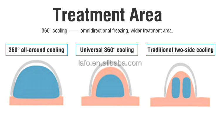 360 Degree Cooling Cryo 2 Handles Cryo Cryotherapy Fat lipolysis Criolipolisis Machine with different cryo cups LF-268A